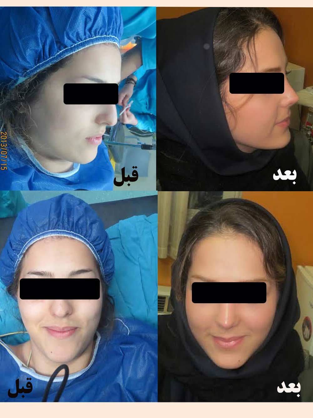 دکتر جراح بینی در شیراز