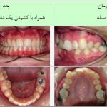 مطب تخصصی ارتودنسی دکتر پروین خرازی در تهران