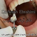 دکتر آرش ابراهیمی
