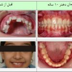 مطب تخصصی ارتودنسی دکتر پروین خرازی در تهران