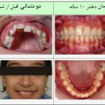 مطب تخصصی ارتودنسی دکتر پروین خرازی در تهران