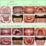 مطب تخصصی ارتودنسی دکتر پروین خرازی در تهران