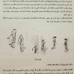 کلینیک پروتز چشم بیناسا در تهران