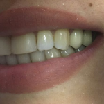 دکتر راضیه بیرانوند در نوشهر