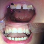 دکتر راضیه بیرانوند در نوشهر