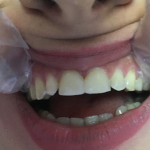 دکتر راضیه بیرانوند در نوشهر