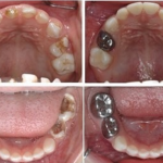 دکتر راضیه بیرانوند در نوشهر