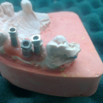 لابراتور تخصصی دندانسازی کوشا در اهواز