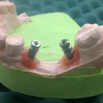 لابراتور تخصصی دندانسازی کوشا در اهواز