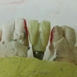 لابراتور تخصصی دندانسازی کوشا در اهواز