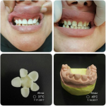 لابراتور تخصصی دندانسازی کوشا در اهواز