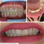 لابراتور تخصصی دندانسازی کوشا در اهواز