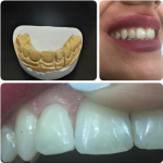 لابراتور تخصصی دندانسازی کوشا در اهواز