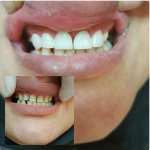 لابراتور تخصصی دندانسازی کوشا در اهواز