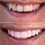 دکتر سمیرا قنبرزاده در رشت