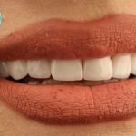 کلینیک تخصصی دندانپزشکی دنیز در تهران