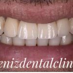 کلینیک تخصصی دندانپزشکی دنیز در تهران