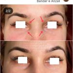 دکتر محمدباقر دیدار شتابان متخصص جراحی عمومی در بندرانزلی