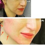 دکتر محمدباقر دیدار شتابان متخصص جراحی عمومی در بندرانزلی