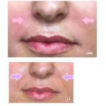 دکتر محمدباقر دیدار شتابان متخصص جراحی عمومی در بندرانزلی