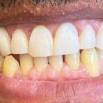دکتر عماد رمضانی جراح و دندانپزشک در لاهیجان