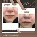 دکتر سایه سیاوش مقدم متخصص پوست و مو در صومعه سرا