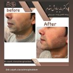 دکتر سایه سیاوش مقدم متخصص پوست و مو در صومعه سرا