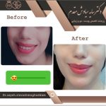 دکتر سایه سیاوش مقدم متخصص پوست و مو در صومعه سرا