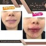 دکتر سایه سیاوش مقدم متخصص پوست و مو در صومعه سرا