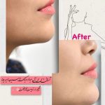 دکتر سایه سیاوش مقدم متخصص پوست و مو در صومعه سرا