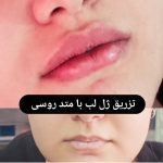 دکتر نوشین حیدریان در کرمانشاه