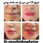 دکتر نوشین حیدریان در کرمانشاه