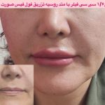 دکتر نوشین حیدریان در کرمانشاه