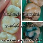 دکتر آرش ابراهیمی