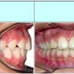 مطب تخصصی ارتودنسی دکتر پروین خرازی در تهران