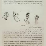 کلینیک پروتز چشم بیناسا در تهران