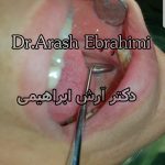 دکتر آرش ابراهیمی