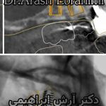 دکتر آرش ابراهیمی