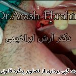 دکتر آرش ابراهیمی