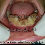 دکتر آرش ابراهیمی