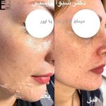 دکتر شیوا کاسبی متخصص پوست در رشت