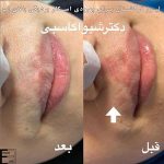 دکتر شیوا کاسبی متخصص پوست در رشت