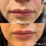 دکتر شیوا کاسبی متخصص پوست در رشت