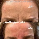 دکتر شیوا کاسبی متخصص پوست در رشت