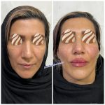 دکتر میثم رمضانپور در تهران