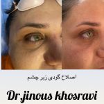 دکتر ژینوس خسروی در تهران