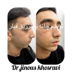 دکتر ژینوس خسروی در تهران