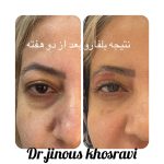دکتر ژینوس خسروی در تهران