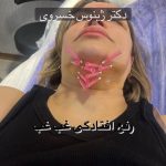 دکتر ژینوس خسروی در تهران