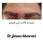 دکتر ژینوس خسروی در تهران